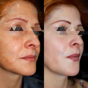 Slider image (8) Dr. Fernando Munar - Plastic Surgery
